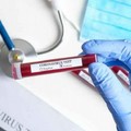Coronavirus, 1023 nuovi casi e 54 decessi in Puglia