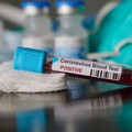 Coronavirus, 35 decessi in Puglia di cui 15 nella Bat